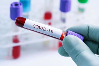 Günün koronavirus statistikası: 1465 yoluxma, 805 sağalma