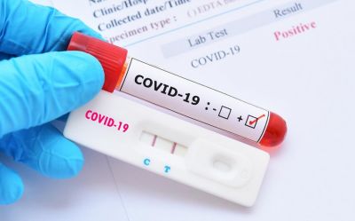 Yığma komandalarım koronavirus testindən keçdilər: nəticələr necədi?